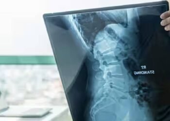 SMA रोगियों के लिए समर्पित देखभाल की आवश्यकता