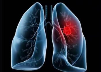 फेफड़ों के कैंसर का बढ़ता खतरा: अनुवांशिक और पारिवारिक कारकों की भूमिका
