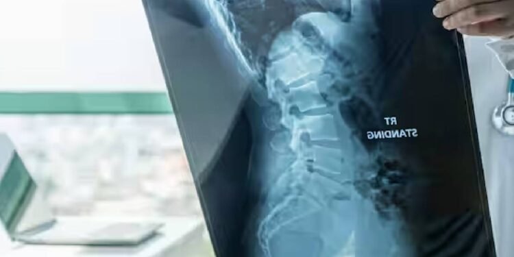 यह दुर्लभ रोग नवजात शिशुओं को पहले 6 महीनों में पकड़ सकता है, समय रहते पहचान न होने पर हो सकता है देर