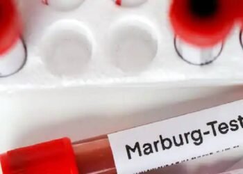 अफ्रीका में फैला घातक 'ब्लीडिंग आई वायरस': रवांडा में 15 लोगों की मौत, अमेरिका और ब्रिटेन ने दी चेतावनी