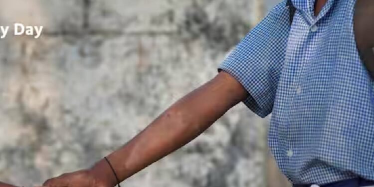 'असाध्य', 'अभिशाप', 'अत्यधिक संक्रामक' - डॉक्टर ने कुष्ठ रोग से जुड़े 7 मिथकों की सूची दी है जिन पर आपको विश्वास करना बंद कर देना चाहिए