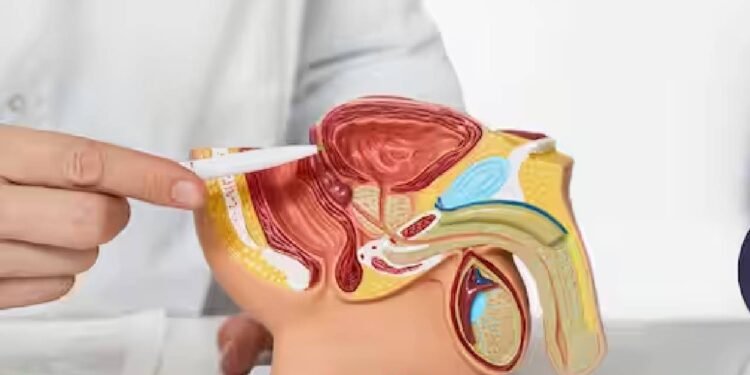 इजराइल के प्रधानमंत्री नेतन्याहू ने प्रोस्टेटेक्टॉमी करवाई; प्रोस्टेट हटाना क्या होता है? समझाया गया