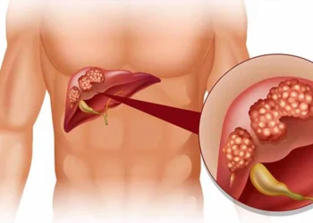 चेहरे और हाथों की त्वचा पर दिखें ये लक्षण तो हो जाएं सावधान, ये लिवर खराब होने का है संकेत